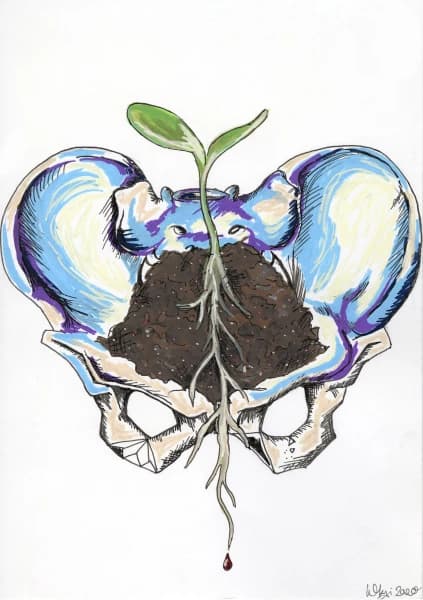 Planted in Pelvis